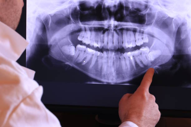 Best Emergency Root Canal Treatment in Ellisville, MS
